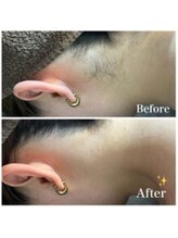 ファム(fam.)/うなじBefore,After