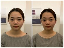 アニュームーン 上本町店(a New Moon)/