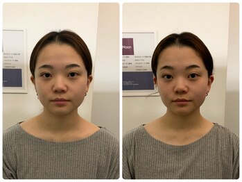 アニュームーン 上本町店(a New Moon)/