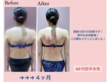 じぶんdeエステ 梅田店/CELLZERO.式　症例/4回/-6kg