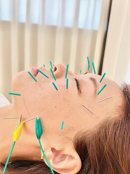 えにし整体 鍼灸整骨院/美容鍼灸の効果をさらにUP☆