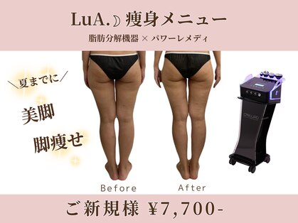 ルア(LuA.)の写真