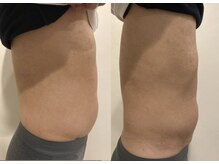 フラットベリー 恵比寿(Flat BELLY)/上半身集中100分コース