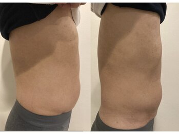 フラットベリー 恵比寿(Flat BELLY)/上半身集中100分コース