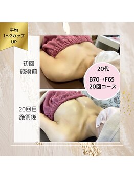 ロココ 町田店(Rococo)/B→Fの4カップUP!