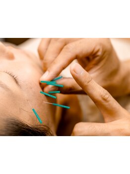 鍼灸施術を受けたい