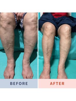 ケンビラク(Kenbiraku 健美楽)/お得意様カーヴィー炭酸脚2回！