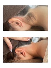 ミース 北九州店/うなじ★ビフォーアフター