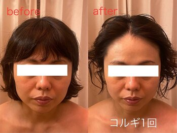 ビーキュート 神戸元町店(BE-CUTE)/コルギ1回目