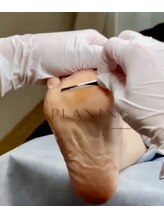 シェリ(Cheri)/韓国角質★ 　エスプランニング