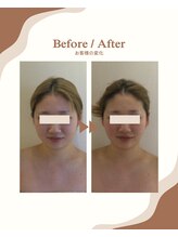 ビーキュート 学芸大学店(BE-CUTE)/Before/After　施術