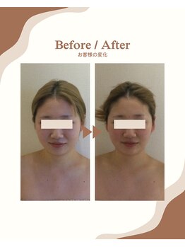 ビーキュート 学芸大学店(BE-CUTE)/Before/After 施術