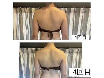 エスデザイン(es design)/肩甲骨/デコルテマッサージ