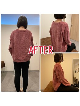 ジェイペック鍼灸整骨院/全身矯正AFTER