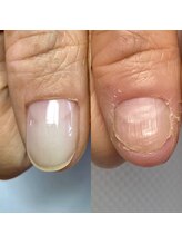 ラピスラズリ(lapislazuli)/◇自爪育成◇