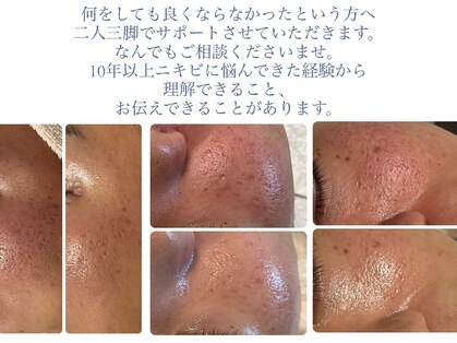 サロン ド エメ(salon de aimer)の写真