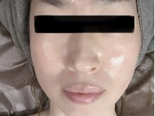 リカルム(Recalme)/45歳