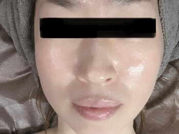 リカルム(Recalme)/45歳