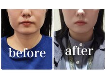 クリーム 京都店(Cream)/