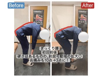 アンティオール 札幌店/60代男性　ぎっくり