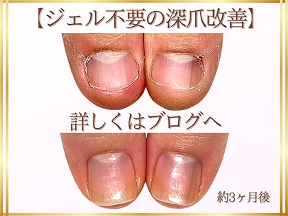 ステラルーテ(Stella lute)の写真