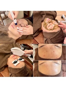 ジン フォー ユアビューティー(JIN for your beauty)の写真/その場限りではなく、これからの素肌に寄り添うサロン