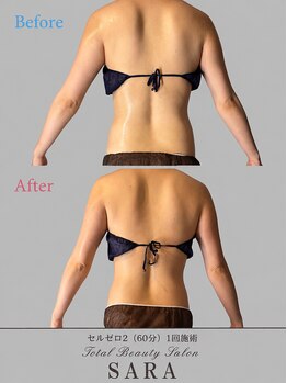 サラ(SARA)の写真/浜松市で本気のサイズダウン。痩身・ダイエット専門SARAで理想のボディラインへ