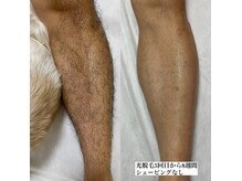 リルモナ(RIREMONA)/