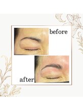 グランミューズ(Gran Muse)/ハリウッドブロウリフト