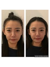 アニュームーン 上本町店(a New Moon)/