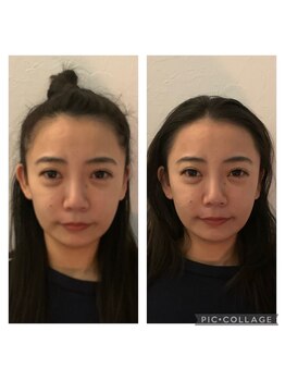 アニュームーン 上本町店(a New Moon)/