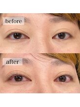 アイサロン アンドアン(eye salon &anne)/目の縦幅こんなに変わりました！