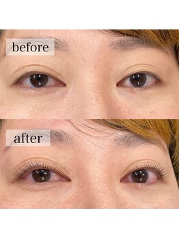 アイサロン アンドアン(eye salon &anne)/目の縦幅こんなに変わりました！