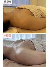 ラビス(RAVIS)/20代☆本格ケアふわふわDカップ