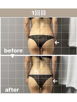 メゾン ド クロエ(Maison de Chloe)/CHLOE式パーソナル痩身