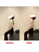 ナオル整体 福岡香椎院(NAORU整体)/20代女性施術事例【首肩こり】