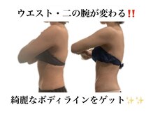 痩身革命 大宮店/ダイエットリンパマッサージ