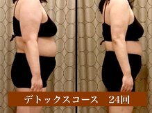 サロン セドナ(SALON SEDONA)/デトックス痩身 24回コース　