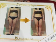 ビューティーボディー 小岩(Beauty Body)/