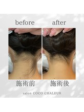 ココ シャルール(salon COCO CHALEUR)/Before　After