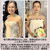 蒼(so)