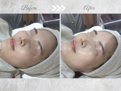 ソワナ(soina)の写真