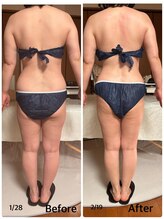 ジフィー(Gify)/筋膜リリースカッターBody