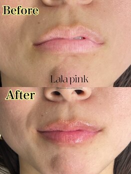 カルム(Calme)/Lalapink