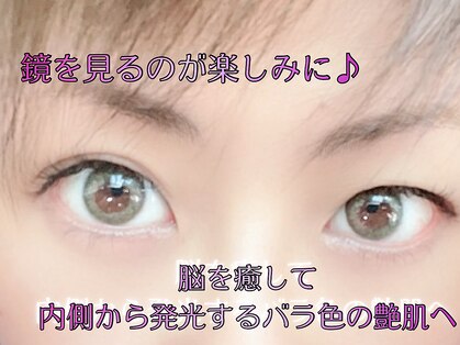アネム(Anemu lune)の写真