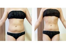 ラトゥリア(laturia)/ウエストお腹が気になる方に◎