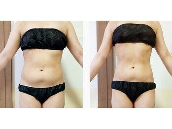 ラトゥリア(laturia)/ウエストお腹が気になる方に◎