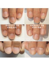 ニコプラス(NICO+)/ジェルネイルができない方向け