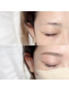 リヨン(LYON+831)/