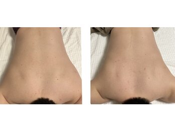 メグムサロン(Megumu Salon)/空ルート/肩こり腰痛/マッサージ